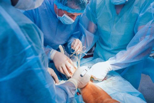 Fractura y Cirugia de Pie